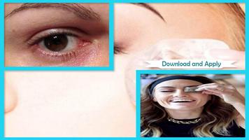 Puffy Eyes Solutions Tips 스크린샷 2