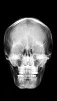 X-ray Body Scanner Prank screenshot 1