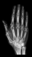 X-ray Body Scanner Prank ảnh chụp màn hình 3