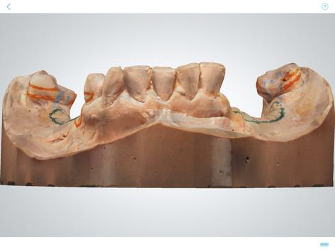 3Shape Dental System™ 截图 1