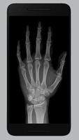 X-ray Scanner Prank (camera scan) تصوير الشاشة 1
