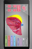 Surgical Anatomy of the Liver poster