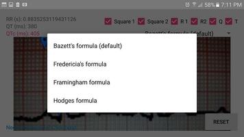 1 Schermata ECG: QTc Calculator