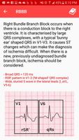 Outils ECG capture d'écran 3