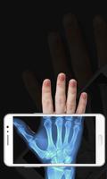 Body Scanner New Xray Real Cloth Camera Prank App-poster