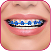 Braces Teeth Beauty photos APK