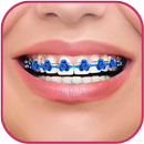 Braces Teeth Beauty photos APK