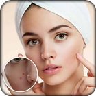Pimple Remover : Beauty Plus icône