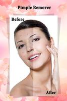 Pimple Remover : Beauty Plus Affiche