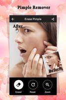 Pimple Remover : Beauty Plus capture d'écran 1
