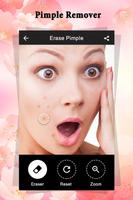 Pimple Remover : Beauty Plus capture d'écran 2