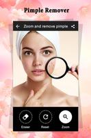 Pimple Remover : Beauty Plus capture d'écran 3
