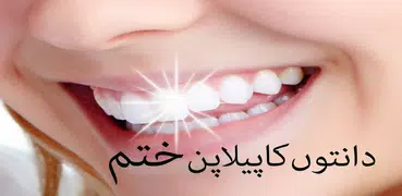 Danto ka Peelapan khatam :Urdu