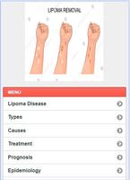 Lipoma Solution Disease capture d'écran 1