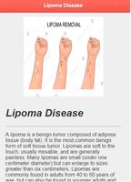 Lipoma Solution Disease capture d'écran 2