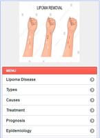 Lipoma Solution Disease capture d'écran 3