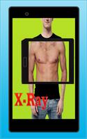 X-Ray Body Scan simulated 海报