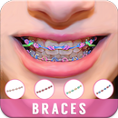 Braces Camera Beauty Selfie APK