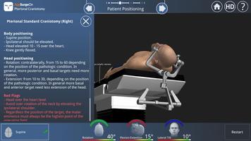 Pterional Craniotomy Ekran Görüntüsü 3