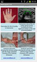 MSK ultrasound upper limb Lite Ekran Görüntüsü 2