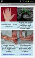 MSK ultrasound upper limb Lite Screenshot 2