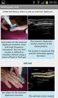 MSK ultrasound upper limb Lite Ekran Görüntüsü 3
