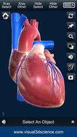 My Heart Anatomy Screenshot 1