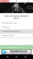 Echocardiography cases screenshot 3