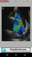 Echocardiography cases capture d'écran 2