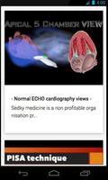 Echocardiography guide screenshot 2