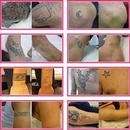 Elimina Tus Tattoos APK