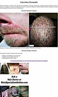 Hair Diseases imagem de tela 2