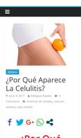 ¿Por Qué Aparece La Celulitis? plakat