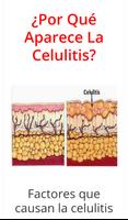 ¿Por Qué Aparece La Celulitis? screenshot 1