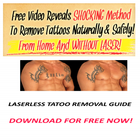 Laserless Tattoo Removal icon