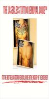 Laserless Tattoo Removal poster