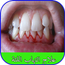 علاج التهاب اللثة APK