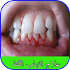 علاج التهاب اللثة icône علاج التهاب اللثة icône