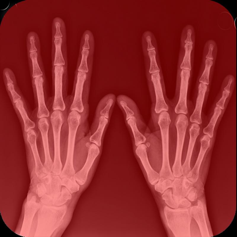 Girl Cloth Xray Scan Simulator APK Download - Free ...