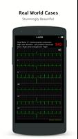 ECG Pro - Real World ECG / EKG captura de pantalla 1