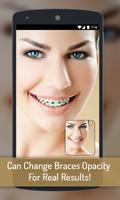 Braces your Teeth Photo Maker capture d'écran 3