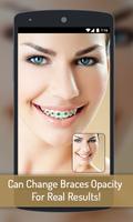 Poster Braces your Teeth Photo Maker