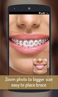 Braces your Teeth Photo Maker capture d'écran 2