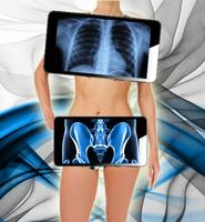 X-ray Prank a Scan Plakat