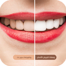 وصفات العناية بالأسنان | وصفات تبييض الاسنان APK