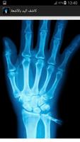كاشف عظام اليد X-Ray Prank imagem de tela 2