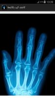 كاشف عظام اليد X-Ray Prank imagem de tela 3