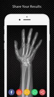 Xray Scanner Prank capture d'écran 3