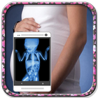 Icona X Ray Scanner Pregnant Prank