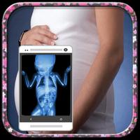 X Ray Scanner Pregnant Prank الملصق